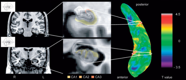 abb2_hippocampus2_brain_2013 abb2_hippocampus2_brain_2013