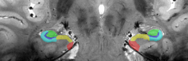 abb3_subfields_hippocampus abb3_subfields_hippocampus
